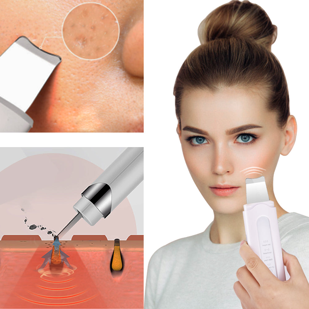 Máquina Exfoliación en uso